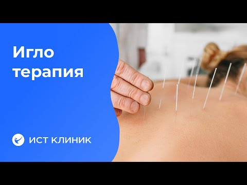 Видео: Иглотерапия - польза или вред?