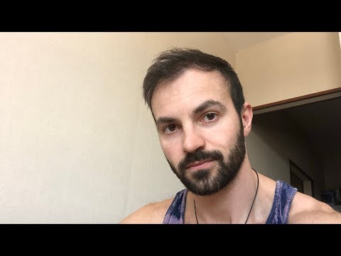 Видео: Пересадка волос в Турции. 365 дней с момента пересадки.