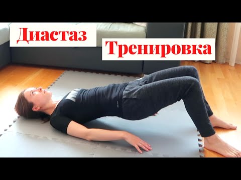 Видео: Упражнения, которые рекомендуют швейцарские врачи при диастазе