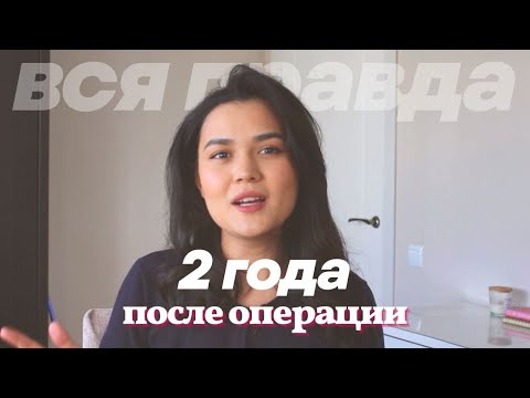 Видео: ЛАЗЕРНАЯ КОРРЕКЦИЯ ЗРЕНИЯ | обязательно к просмотру