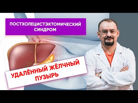 Видео: Удалённый жёлчный пузырь - постхолецистэктомический синдром.