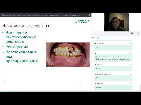 Видео: Пришеечные дефекты (Вебинар от 12.12.17)