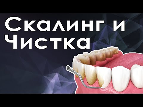 Видео: Пескоструйная чистка зубов и скалинг