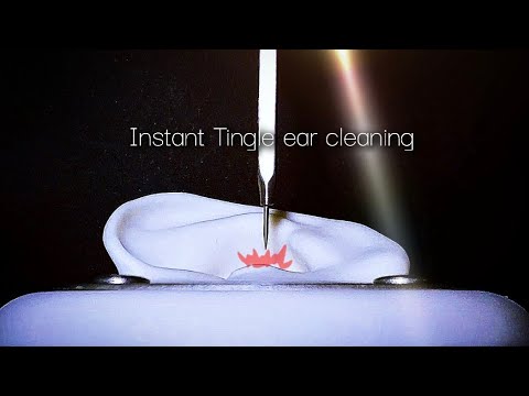 Видео: ASMR Интенсивное очищение ушей, при котором можно почувствовать покалывание в течение 1 секунды❤️