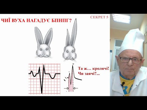 Видео: Chapter-5: Блокади серця: діагностика. Електрокардіостимуляція. #proECG