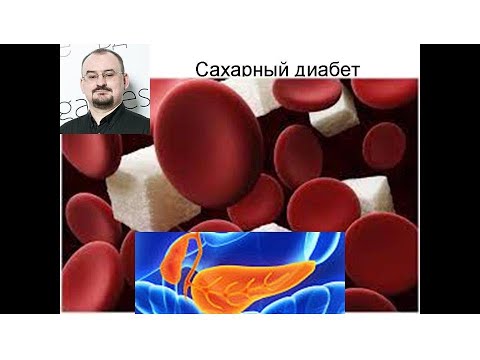 Видео: Эндокринная часть поджелудочной железы. Сахарный диабет, первый и второй тип.