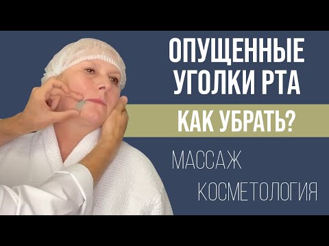 Видео: МОРЩИНЫ МАРИОНЕТКИ, ОПУЩЕННЫЕ УГОЛКИ РТА ‼ КАК УБРАТЬ С ПОМОЩЬЮ МАССАЖА ИЛИ ПРОЦЕДУР