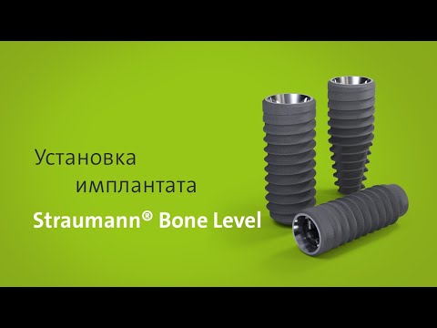 Видео: Установка имплантата: Straumann® Bone Level