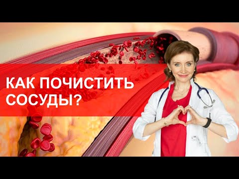 Видео: Как почистить сосуды?