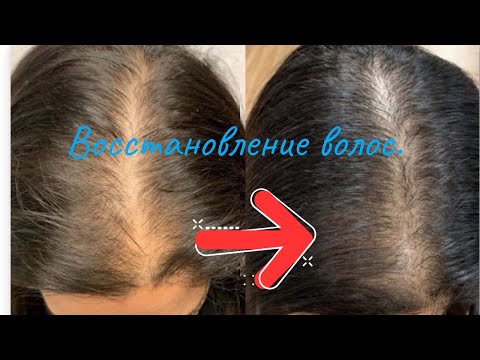 Видео: Восстановление волос за 50 руб! В аптеке ЭТО стоит копейки, а косметика с этим стоит в разы дороже!
