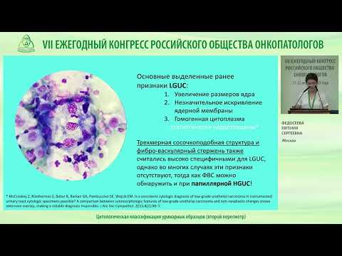 Видео: Цитологическая классификация уринарных образцов (второй пересмотр)