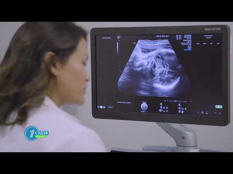 Видео: Жирэмсний ургийн гажгийг тодорхойлох шинжилгээ