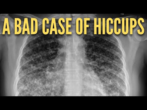 Видео: Интересный, но неудачный медицинский случай