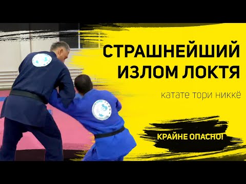 Видео: Страшнейший излом локтя! Крайне опасно!