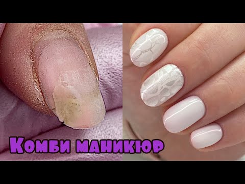 Видео: Укрепление ногтей акригелем/полигелем 💅 Комбинированный маникюр / Дизайн ногтей стемпинг