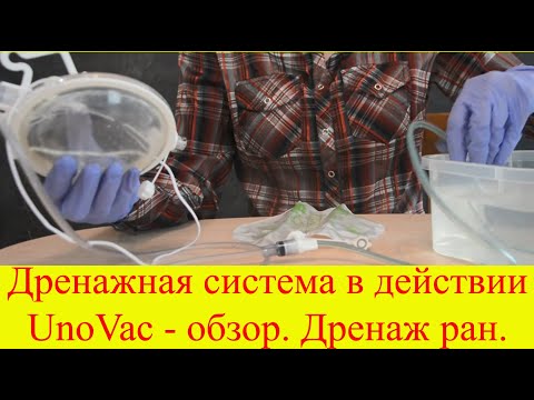 Видео: Низковакуумная система закрытая для дренирования ран UnoVac