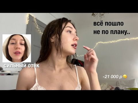 Видео: я УВЕЛИЧИЛА ГУБЫ (шок)