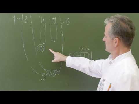 Видео: Пластика пахового канала по Лихтенштейну