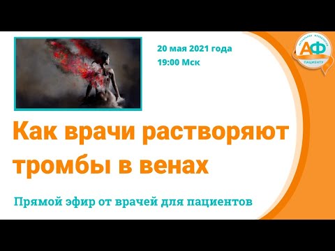 Видео: Как врачи растворяют тромбы в венах