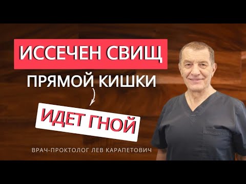 Видео: Иссечен СВИЩ ПРЯМОЙ КИШКИ - идёт гной