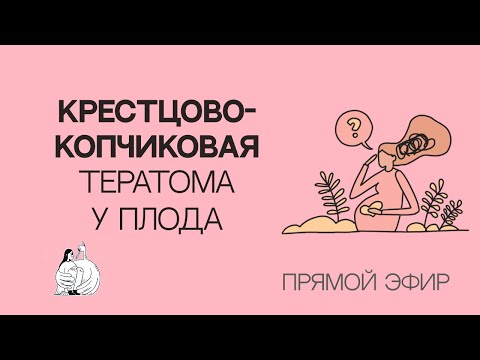Видео: Крестцово-копчиковая тератома у плода. История про веру, мудрость и безграничную любовь