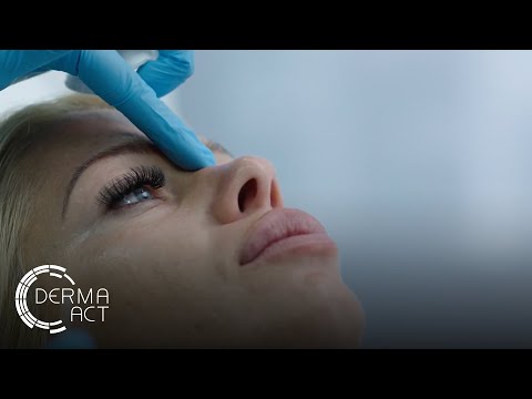 Видео: Поставяне на филър в областта на носа