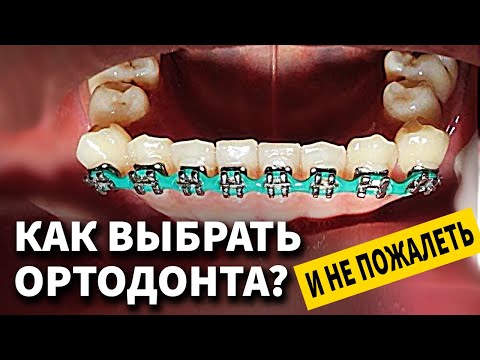 Видео: Как выбрать ортодонта? Поставить брекеты и не пожалеть.