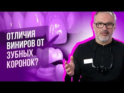 Видео: Что лучше коронки или виниры?