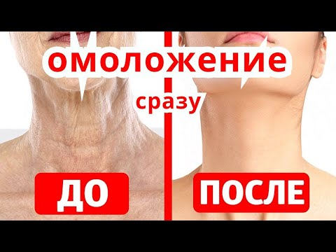 Видео: Шея в 70 как в 35 лет ПОСЛЕ ЭТОЙ ПРОЦЕДУРЫ  БЕЗ САЛОНА ! от морщин, дряблости и пятен