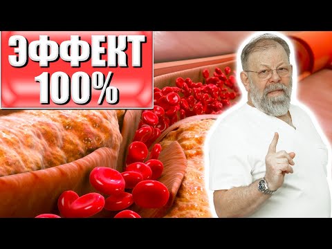 Видео: ЭФФЕКТ - 100%!!! СОСУДЫ ИДЕАЛЬНЫЕ