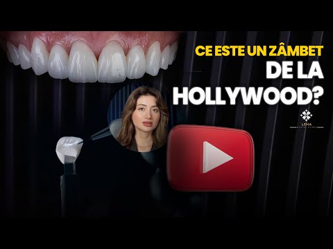 Видео: 🤍 Что такое голливудская улыбка? — Стоматологическая клиника Lema