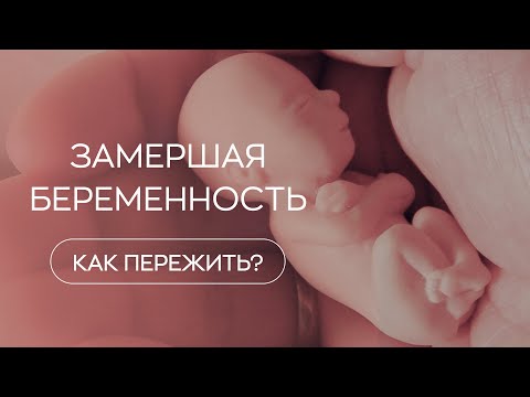 Видео: 👋​ Как помочь себе при замершей беременности?