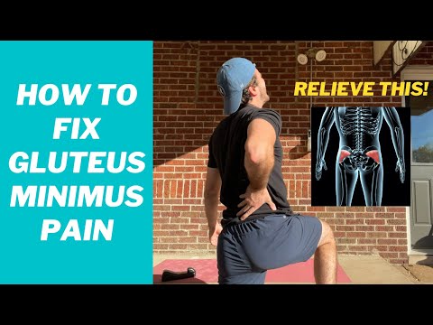 Видео: Коварная боль в малой ягодичной мышце и как ее устранить