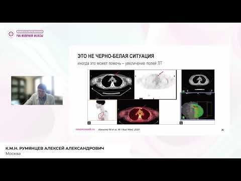 Видео: Как не нужно делать ПЭТ-КТ после радикального лечения РМЖ