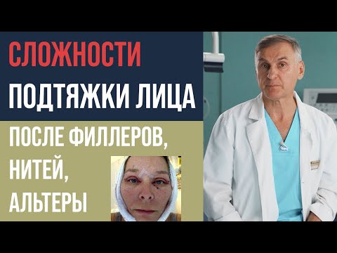 Видео: КРУГОВАЯ ПОДТЯЖКА ЛИЦА 🤕  СМАС ПОДТЯЖКА ПОСЛЕ ФИЛЛЕРОВ, НИТЕЙ, АЛЬТЕРЫ?
