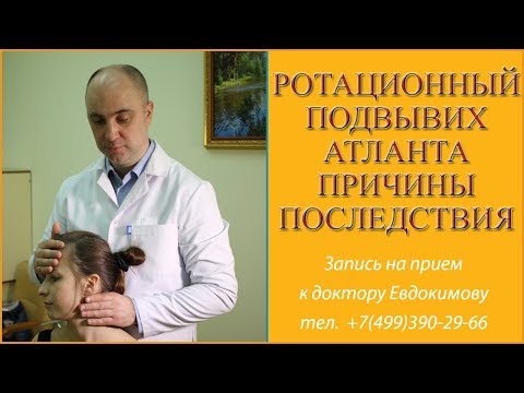 Видео: Ротационный подвывих атланта.  Причины и последствия.
