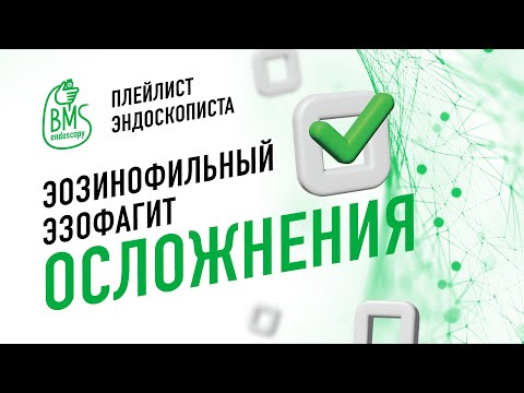 Видео: 🟢Стеноз при эозинофильном эзофагите #playlistэндоскописта / клинический случай #стеноз  #эгдс