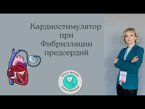 Видео: Кардиостимулятор при фибрилляции предсердий