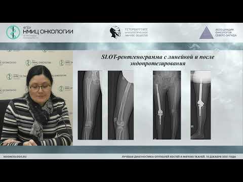 Видео: Применение SLOT-рентгенографии при патологии костей