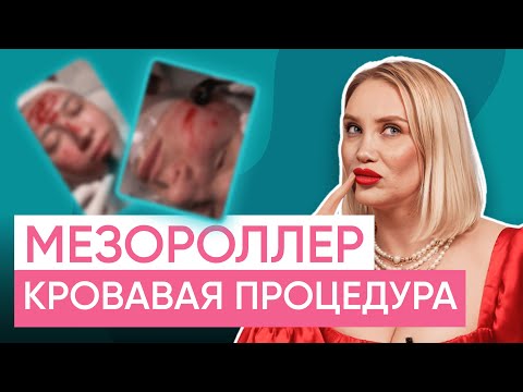 Видео: Вся правда про мезороллер! Реально ли он помогает и как проходит реабилитация?