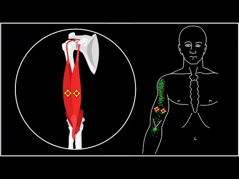 Видео: БОЛИТ РУКА ОТ ПЛЕЧА ДО ЛОКТЯ: ДВУГЛАВАЯ МЫШЦА ПЛЕЧА (БИЦЕПС)