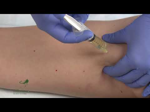 Видео: Практическое занятие Мезотерапия тела