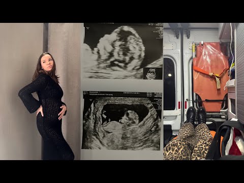 Видео: Я БЕРЕМЕННА/ 1 триместр🤰🏻