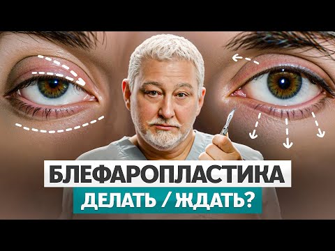 Видео: Блефаропластика — как понять, нужна ли пластика век