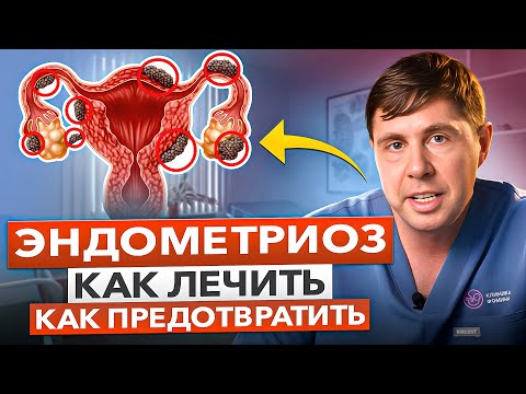 Видео: Эндометриоз. Сиоптомы и новый метод лечения эндометриоза. Как понять, что у вас эндометриоз.