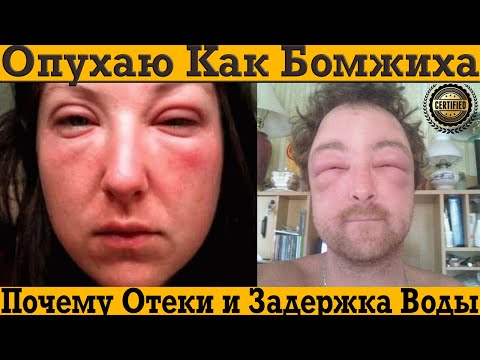 Видео: Ужасно опухаю и страшная задержка воды в организме! Как слить воду?!