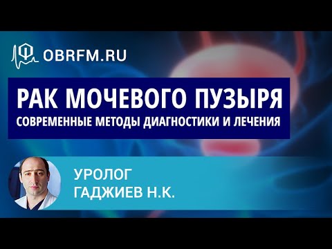 Видео: Уролог Гаджиев Н.К.: Рак мочевого пузыря. Современные методы диагностики и лечения