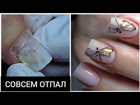 Видео: УЖАСНАЯ отслойка