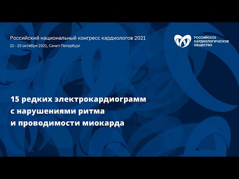 Видео: Мастер-класс «15 редких электрокардиограмм с нарушениями ритма и проводимости миокарда»