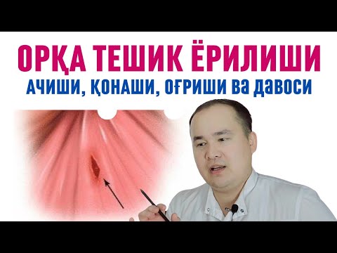 Видео: ОРҚА ТЕШИК ЁРИЛИШИ, АЧИШИ, ҚОНАШИ, ОҒРИШИ АНАЛ ТРЕЩИНА САБАБИ ВА УЙ ШАРОИТИДА ДАВОСИ ДАҚҚИДА ИСЧАНОВ